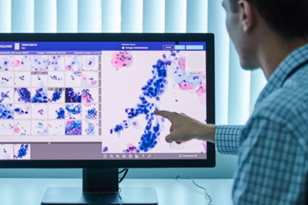 Sundhedspersonale kigger på scanningsbilleder på en skærm