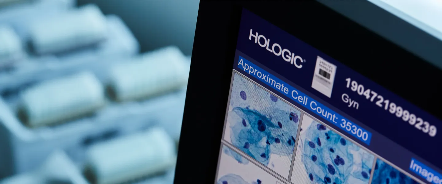 Cytologiprøver på objektglas og hjørnet af en skærm, der viser digitale cytologisvar, klar til analyse.