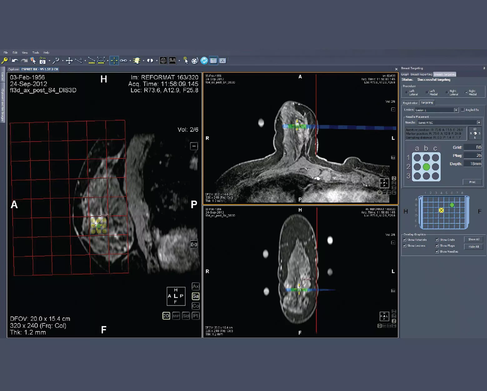 MultiView-skærmbillede