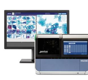 Hologic Genius™ Digital Diagnostics System på hvid baggrund
