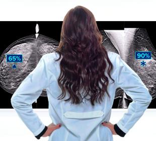 Hologic Genius AI™ Detection Technology på hvid baggrund