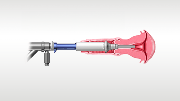 Illustration af medicinsk enheder, der er i brug.